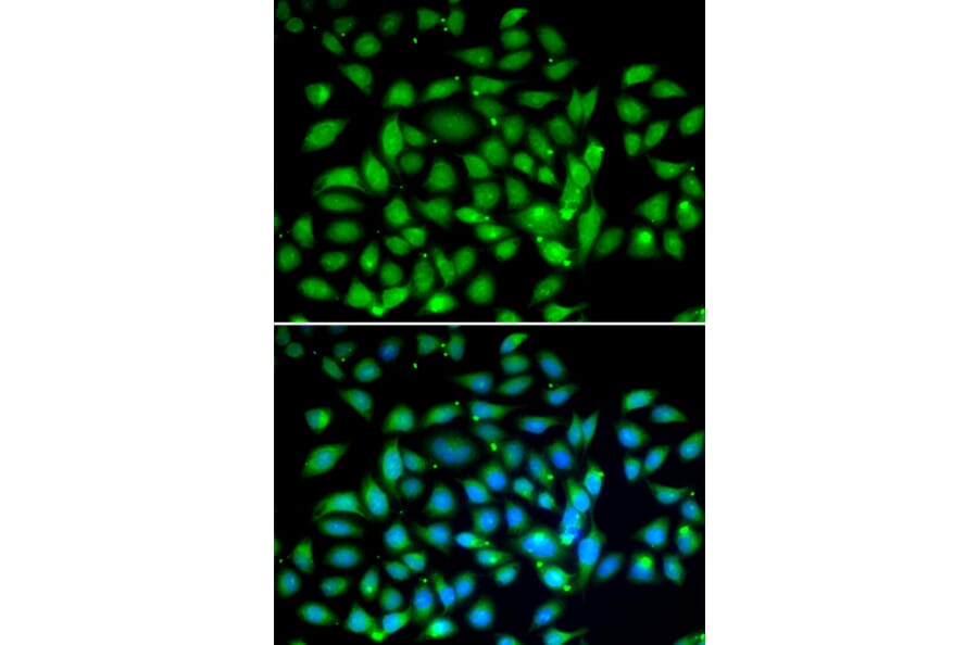 Immunofluorescence - Anti-MeCP2 Antibody (A90334) - Antibodies.com