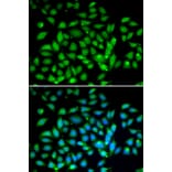 Immunofluorescence - Anti-MeCP2 Antibody (A90334) - Antibodies.com