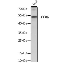 Western Blot - Anti-CCR6 Antibody (A90335) - Antibodies.com