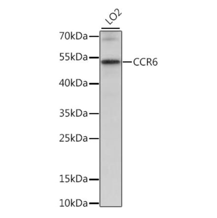 Western Blot - Anti-CCR6 Antibody (A90335) - Antibodies.com