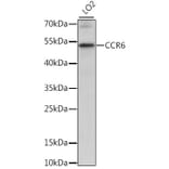 Western Blot - Anti-CCR6 Antibody (A90335) - Antibodies.com
