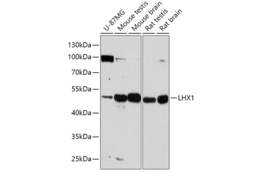 Western Blot - Anti-LIM1/LHX1 Antibody (A90336) - Antibodies.com