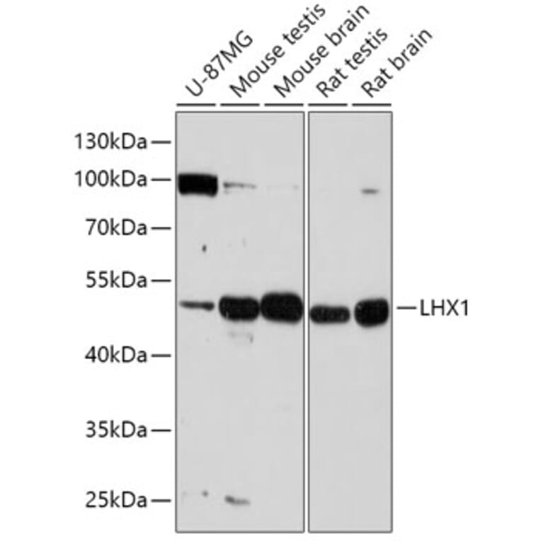 Western Blot - Anti-LIM1/LHX1 Antibody (A90336) - Antibodies.com