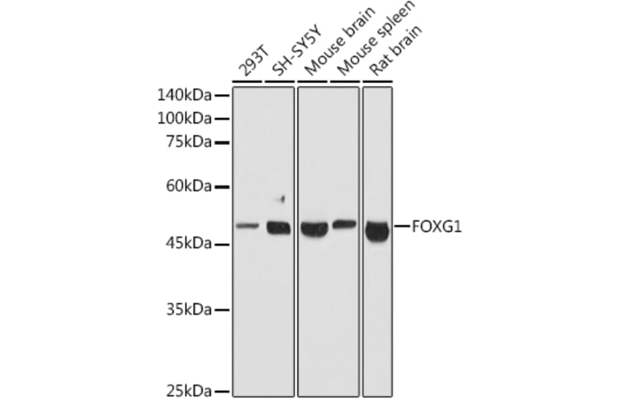 Western Blot - Anti-FOXG1 Antibody (A90338) - Antibodies.com