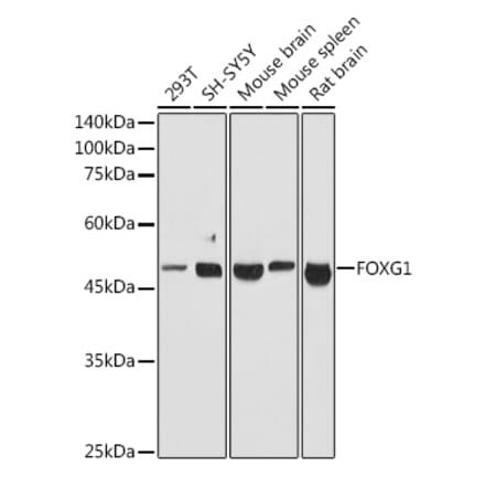Western Blot - Anti-FOXG1 Antibody (A90338) - Antibodies.com