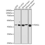 Western Blot - Anti-FOXG1 Antibody (A90338) - Antibodies.com