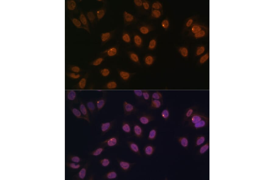 Immunofluorescence - Anti-FOXG1 Antibody (A90338) - Antibodies.com