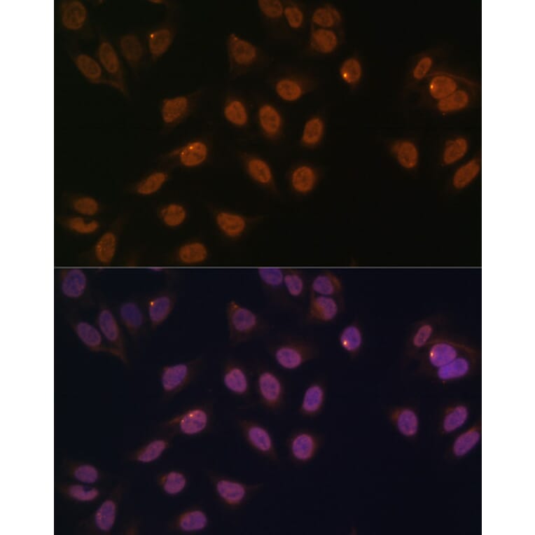 Immunofluorescence - Anti-FOXG1 Antibody (A90338) - Antibodies.com