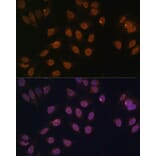 Immunofluorescence - Anti-FOXG1 Antibody (A90338) - Antibodies.com