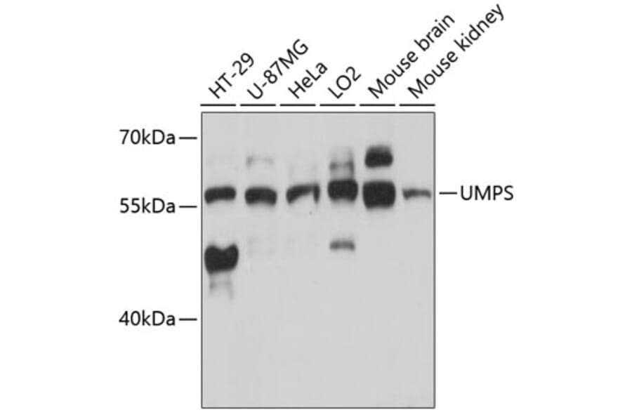 Western Blot - Anti-OPRT Antibody (A90339) - Antibodies.com
