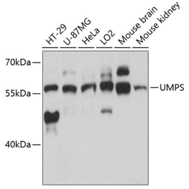 Western Blot - Anti-OPRT Antibody (A90339) - Antibodies.com