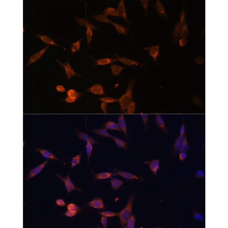 Immunofluorescence - Anti-OPRT Antibody (A90339) - Antibodies.com