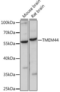 Western blot analysis of extracts of various cell lines, using Anti-TMEM44 Antibody (A15929) at 1:1,000 dilution.
Secondary antibody: Goat Anti-Rabbit IgG (H+L) (HRP) (AS014) at 1:10,000 dilution.
Lysates / proteins: 25µg per lane.
Blocking buffer: 3% non-fat dry milk in TBST.
Detection: ECL Basic Kit (RM00020).
Exposure time: 30s.