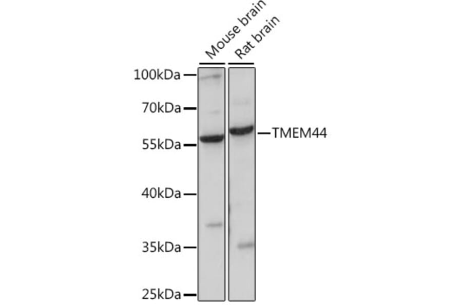 Western Blot - Anti-TMEM44 Antibody (A90340) - Antibodies.com