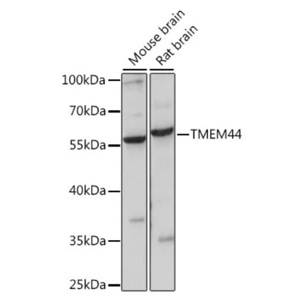 Western Blot - Anti-TMEM44 Antibody (A90340) - Antibodies.com