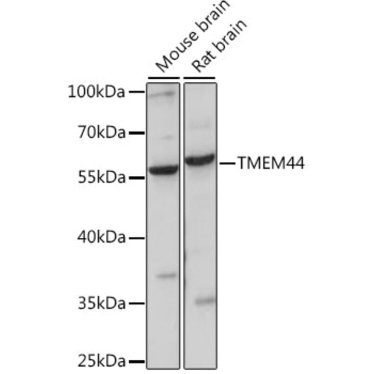 Western Blot - Anti-TMEM44 Antibody (A90340) - Antibodies.com