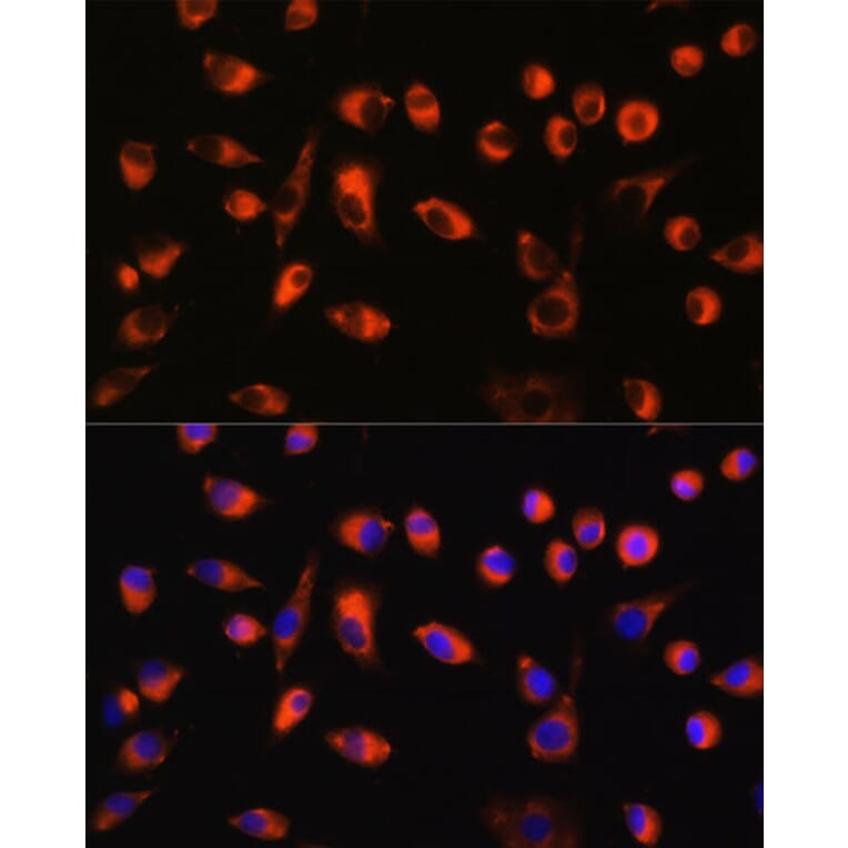 Immunofluorescence - Anti-TMEM44 Antibody (A90340) - Antibodies.com
