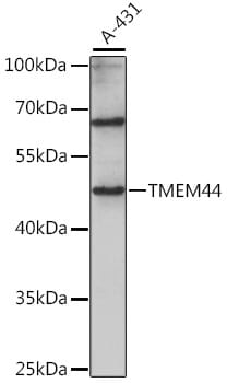 Western blot analysis of extracts of A-431 cells, using Anti-TMEM44 Antibody (A15932) at 1:1,000 dilution.
Secondary antibody: Goat Anti-Rabbit IgG (H+L) (HRP) (AS014) at 1:10,000 dilution.
Lysates / proteins: 25µg per lane.
Blocking buffer: 3% non-fat dry milk in TBST.
Detection: ECL Basic Kit (RM00020).
Exposure time: 30s.