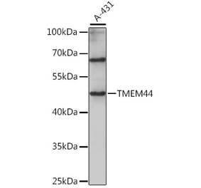 Western Blot - Anti-TMEM44 Antibody (A90341) - Antibodies.com