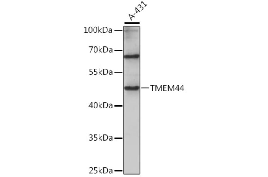 Western Blot - Anti-TMEM44 Antibody (A90341) - Antibodies.com