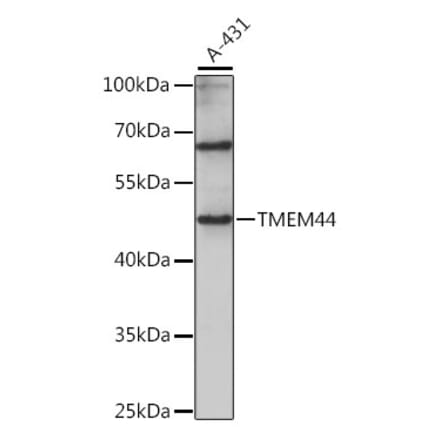 Western Blot - Anti-TMEM44 Antibody (A90341) - Antibodies.com