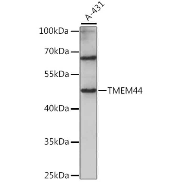 Western Blot - Anti-TMEM44 Antibody (A90341) - Antibodies.com