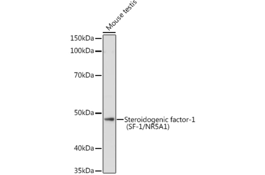 Western Blot - Anti-Steroidogenic Factor 1/SF-1 Antibody (A90342) - Antibodies.com