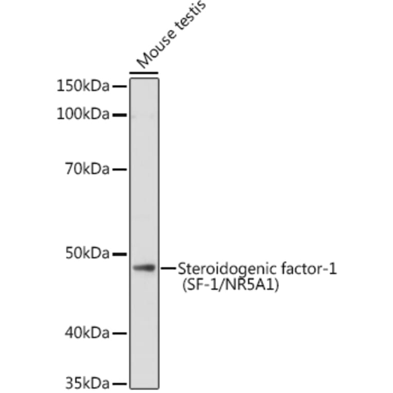Western Blot - Anti-Steroidogenic Factor 1/SF-1 Antibody (A90342) - Antibodies.com