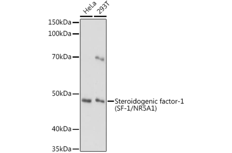 Western Blot - Anti-Steroidogenic Factor 1/SF-1 Antibody (A90342) - Antibodies.com