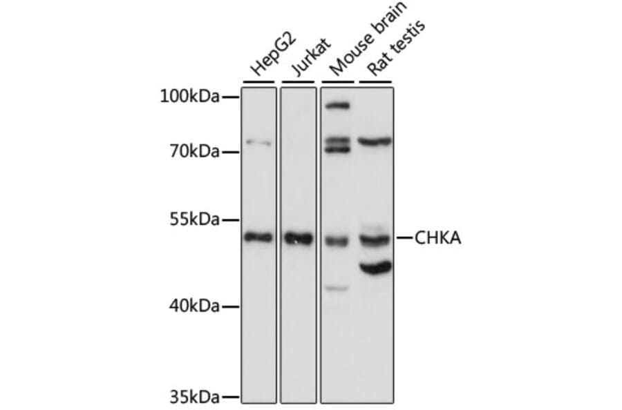 Western Blot - Anti-Choline kinase alpha Antibody (A90343) - Antibodies.com