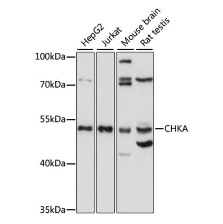 Western Blot - Anti-Choline kinase alpha Antibody (A90343) - Antibodies.com