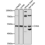 Western Blot - Anti-Choline kinase alpha Antibody (A90343) - Antibodies.com