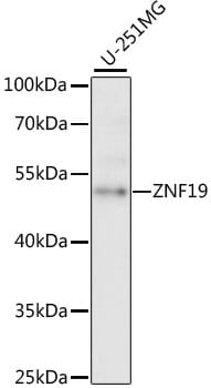 Western blot analysis of extracts of U-251MG cells, using Anti-ZNF19 Antibody (A15328) at 1:1,000 dilution.
Secondary antibody: Goat Anti-Rabbit IgG (H+L) (HRP) (AS014) at 1:10,000 dilution.
Lysates / proteins: 25µg per lane.
Blocking buffer: 3% non-fat dry milk in TBST.
Detection: ECL Basic Kit (RM00020).
Exposure time: 5s.