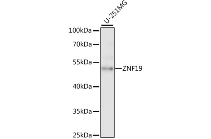 Western Blot - Anti-ZNF19 Antibody (A90344) - Antibodies.com