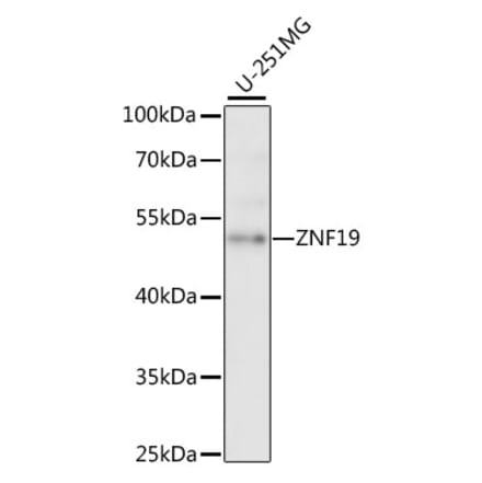 Western Blot - Anti-ZNF19 Antibody (A90344) - Antibodies.com