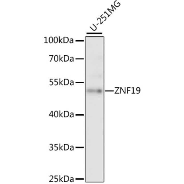 Western Blot - Anti-ZNF19 Antibody (A90344) - Antibodies.com