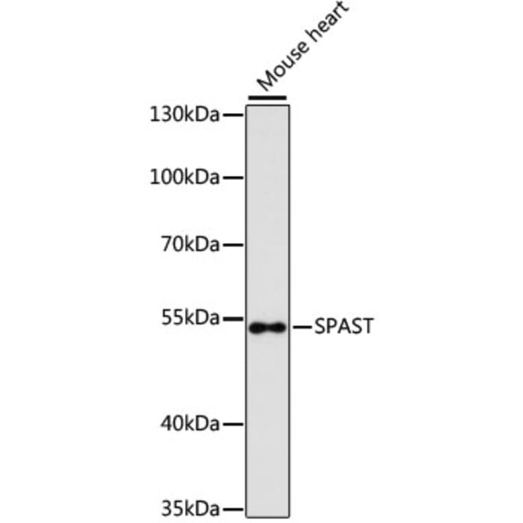Western Blot - Anti-SPAST Antibody (A9543) - Antibodies.com