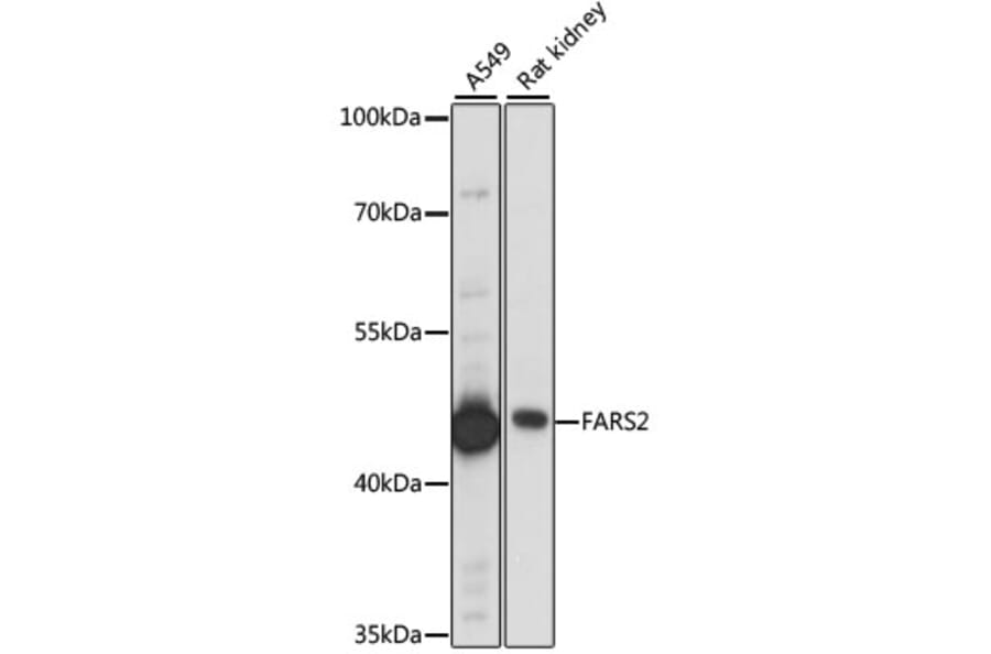 Western Blot - Anti-FARS2 Antibody (A90346) - Antibodies.com