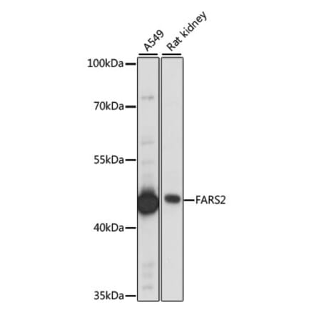 Western Blot - Anti-FARS2 Antibody (A90346) - Antibodies.com