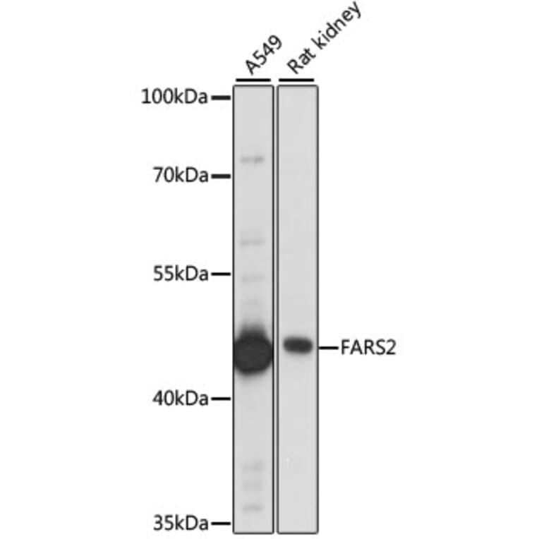 Western Blot - Anti-FARS2 Antibody (A90346) - Antibodies.com