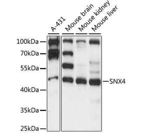 Western Blot - Anti-SNX4 Antibody (A90347) - Antibodies.com