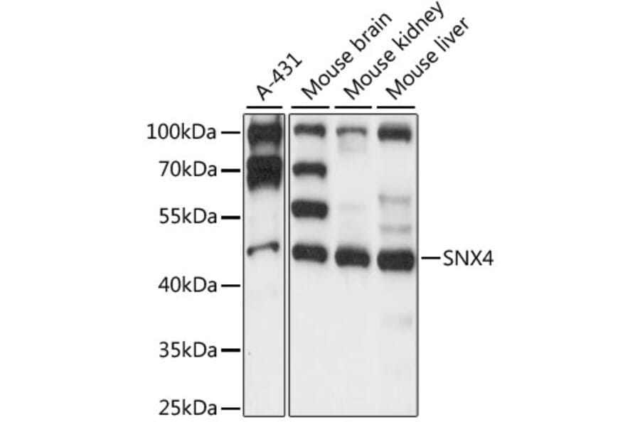 Western Blot - Anti-SNX4 Antibody (A90347) - Antibodies.com