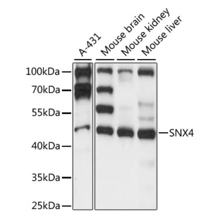 Western Blot - Anti-SNX4 Antibody (A90347) - Antibodies.com