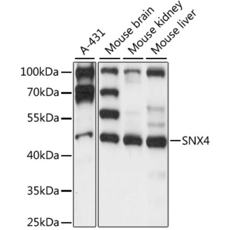 Western Blot - Anti-SNX4 Antibody (A90347) - Antibodies.com