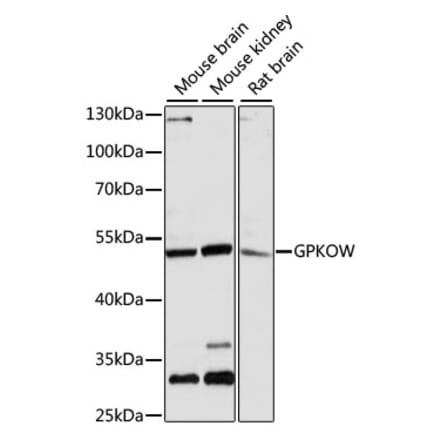 Western Blot - Anti-T54 Antibody (A90348) - Antibodies.com