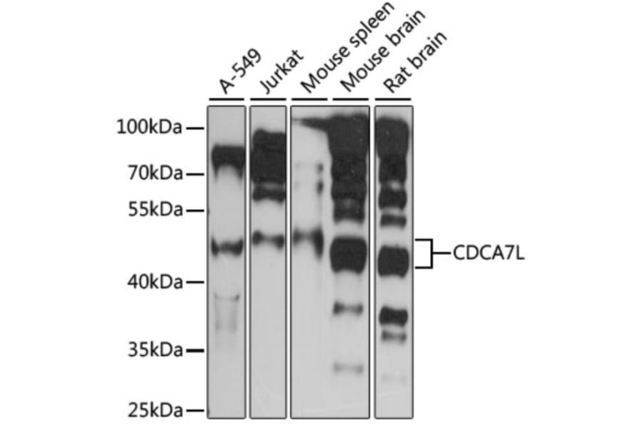 Western Blot - Anti-CDCA7L/HR1 Antibody (A90349) - Antibodies.com