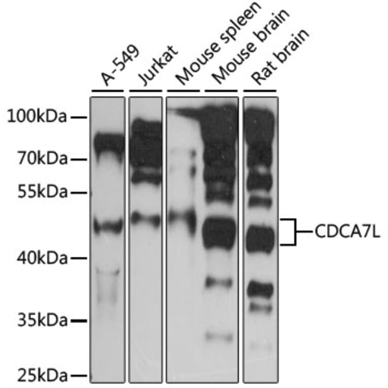 Western Blot - Anti-CDCA7L/HR1 Antibody (A90349) - Antibodies.com