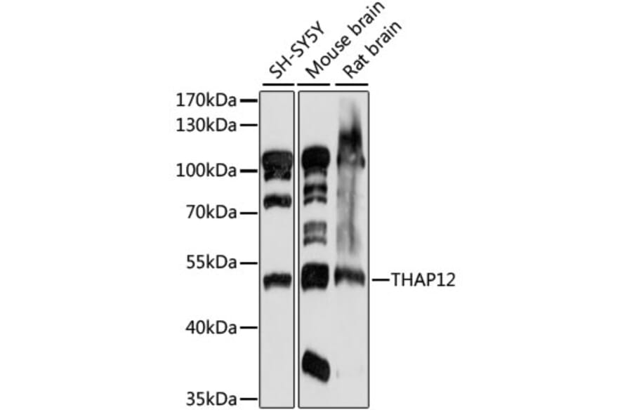 Western Blot - Anti-PRKRIR Antibody (A90350) - Antibodies.com