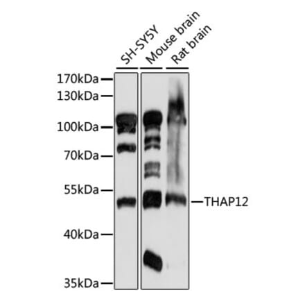 Western Blot - Anti-PRKRIR Antibody (A90350) - Antibodies.com