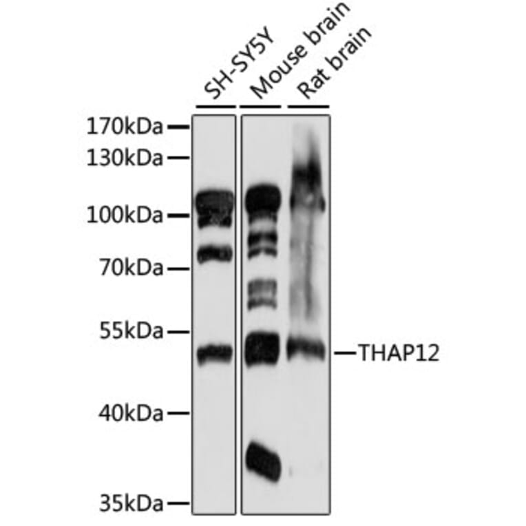 Western Blot - Anti-PRKRIR Antibody (A90350) - Antibodies.com